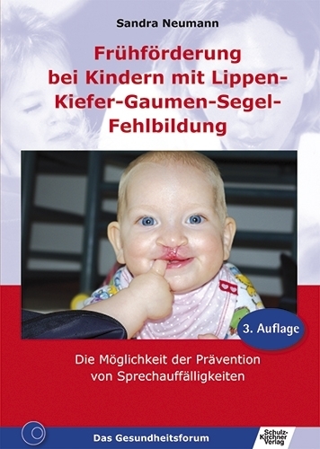 Neumann, Frühförderung bei Kindern mit Lippen-Kiefer-Gaumen-Segel-Fehlbildungen